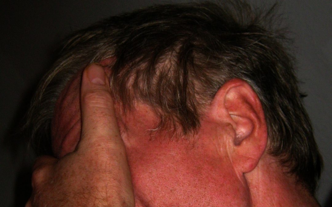 Cluster Headaches: How To Deal With The Worst Headache