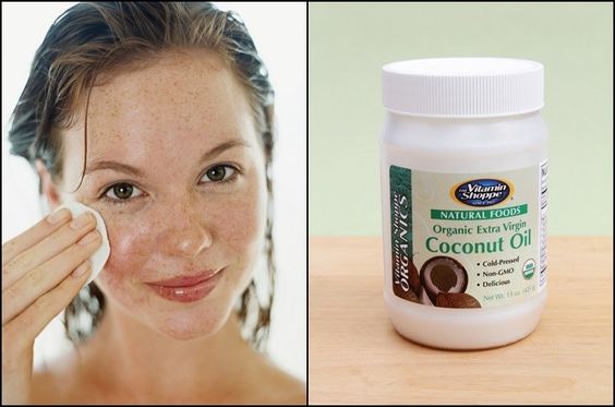12 Natural Remedies To Get Rid Of Blackheads Quickly