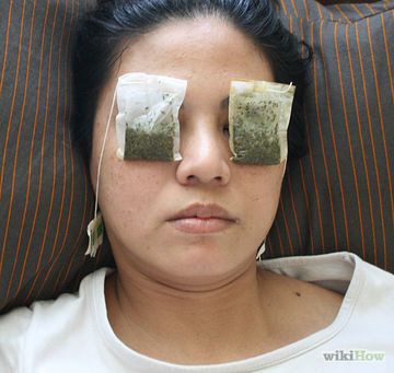 12 Quick And Safe Ways To Get Rid Of A Stye