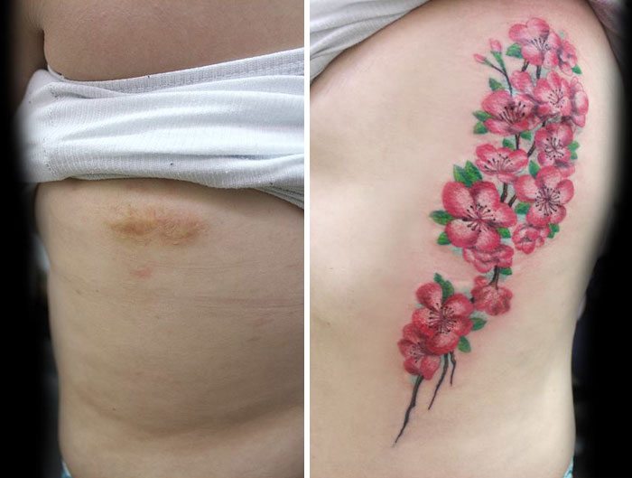 These Free Tattoos Transform The Scars Of Domestic Violence Beautifully